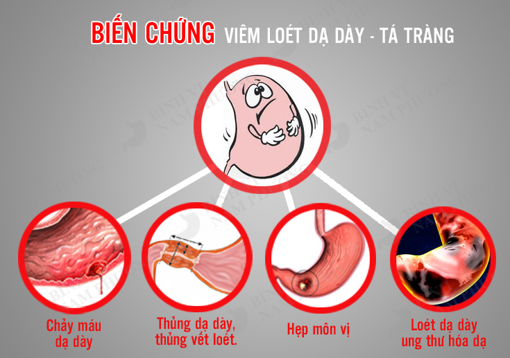 Cây xăng sê: vị cứu tinh của người bị đau dạ dày 3